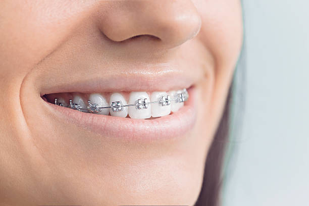 Best Wisdom Tooth Removal  in Crockett, CA